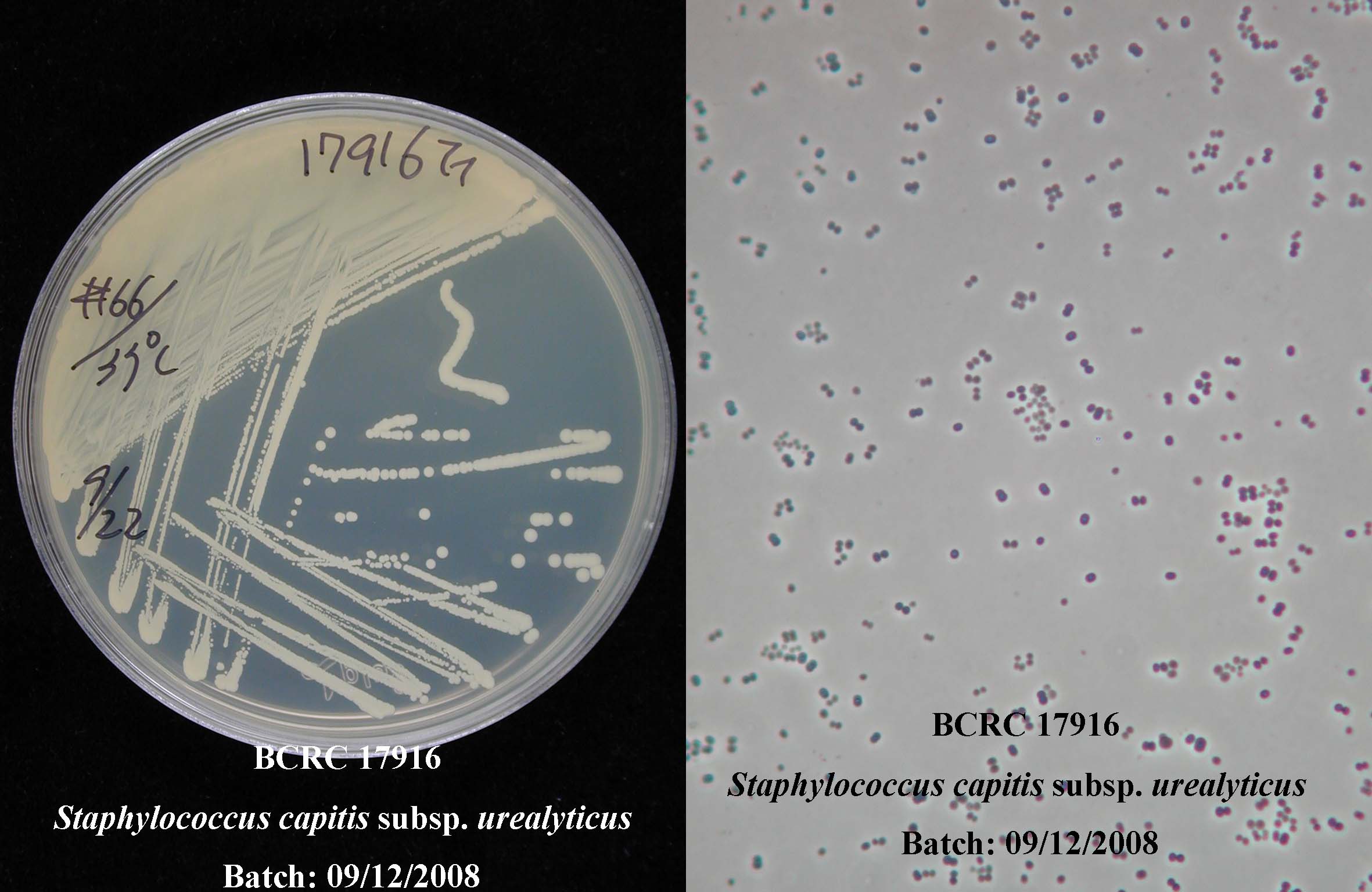 Staphylococcus Capitis Staphylococcus Capitis Bacteria, Sem Beach